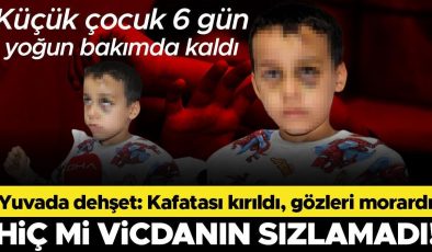 Yuvada bakıcı dehşeti! Dövüp yere fırlattığı çocuğun kafatası kırıldı, gözleri morardı